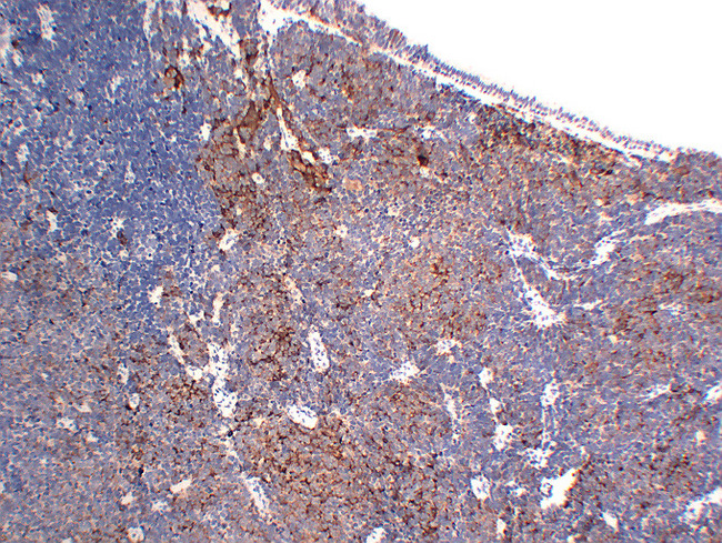 CHGA / Chromogranin A Antibody - Small Cell Lung Carcinoma