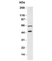 CHGA / Chromogranin A Antibody - Western blot testing of Chromogranin A antibody and Panc-1 lysate. Predicted molecular weight is 50-75 kDa depending on glycosylation level.  This image was taken for the unmodified form of this product. Other forms have not been tested.