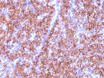 CHGA / Chromogranin A Antibody - Formalin-fixed, paraffin-embedded human parathyroid stained with Chromogranin A antibody (CGA/413).  This image was taken for the unmodified form of this product. Other forms have not been tested.