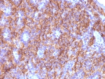 CHGA / Chromogranin A Antibody - Formalin-fixed, paraffin-embedded parathyroid stained with Chromogranin A antibody (CGA/413 + CHGA/777 + CHGA/798).  This image was taken for the unmodified form of this product. Other forms have not been tested.