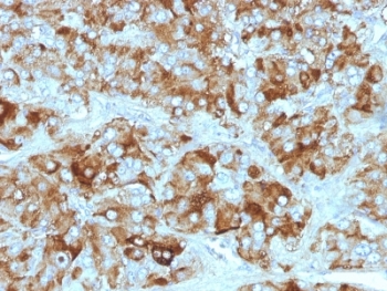 CHGA / Chromogranin A Antibody - Formalin-fixed, paraffin-embedded adrenal gland stained with Chromogranin A antibody cocktail.  This image was taken for the unmodified form of this product. Other forms have not been tested.