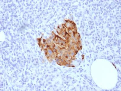 CHGA / Chromogranin A Antibody - Formalin-fixed, paraffin-embedded human Pancreas stained with Chromogranin A Rabbit Recombinant Monoclonal Antibody (CHGA/1773R).