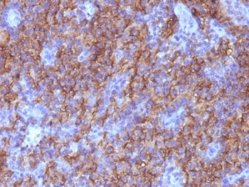 CHGA / Chromogranin A Antibody - Formalin-fixed, paraffin-embedded human parathyroid stained with Chromogranin A antibody (CHGA/765).  This image was taken for the unmodified form of this product. Other forms have not been tested.