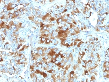 CHGA / Chromogranin A Antibody - Formalin-fixed, paraffin-embedded human adrenal gland stained with Chromogranin A antibody (CHGA/765).  This image was taken for the unmodified form of this product. Other forms have not been tested.