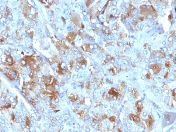 CHGA / Chromogranin A Antibody - Formalin-fixed, paraffin-embedded human adrenal gland stained with Chromogranin A antibody (CHGA/777).  This image was taken for the unmodified form of this product. Other forms have not been tested.