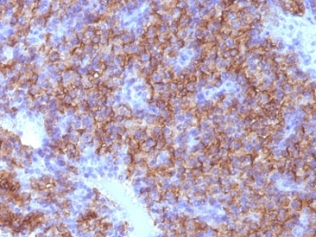 CHGA / Chromogranin A Antibody - Formalin-fixed, paraffin-embedded human parathyroid stained with Chromogranin A antibody (CHGA/798).  This image was taken for the unmodified form of this product. Other forms have not been tested.