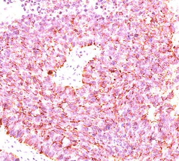 CHGA / Chromogranin A Antibody - Chromogranin A antibody LK2H10 + PHE5 + CGA414 immunohistochemistry.  This image was taken for the unmodified form of this product. Other forms have not been tested.