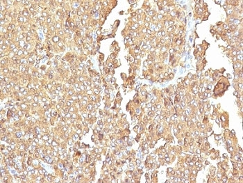 CHGA / Chromogranin A Antibody - Formalin-fixed, paraffin-embedded human adrenal gland stained with Chromogranin A antibody (LK2H10 + PHE5).  This image was taken for the unmodified form of this product. Other forms have not been tested.