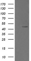 CHGA / Chromogranin A Antibody - HEK293T cells were transfected with the pCMV6-ENTRY control (Left lane) or pCMV6-ENTRY CHGA (Right lane) cDNA for 48 hrs and lysed. Equivalent amounts of cell lysates (5 ug per lane) were separated by SDS-PAGE and immunoblotted with anti-CHGA.