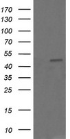 CHGA / Chromogranin A Antibody - HEK293T cells were transfected with the pCMV6-ENTRY control (Left lane) or pCMV6-ENTRY CHGA (Right lane) cDNA for 48 hrs and lysed. Equivalent amounts of cell lysates (5 ug per lane) were separated by SDS-PAGE and immunoblotted with anti-CHGA.