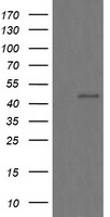 CHGA / Chromogranin A Antibody - HEK293T cells were transfected with the pCMV6-ENTRY control (Left lane) or pCMV6-ENTRY CHGA (Right lane) cDNA for 48 hrs and lysed. Equivalent amounts of cell lysates (5 ug per lane) were separated by SDS-PAGE and immunoblotted with anti-CHGA.