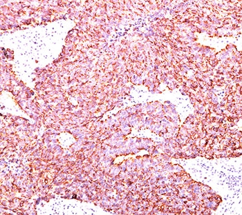 CHGA / Chromogranin A Antibody - Chromogranin A antibody PHE5 immunohistochemistry.  This image was taken for the unmodified form of this product. Other forms have not been tested.