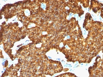 CHGA / Chromogranin A Antibody - Formalin-fixed, paraffin-embedded human pancreas stained with Chromogranin A antibody (SPM553).  This image was taken for the unmodified form of this product. Other forms have not been tested.