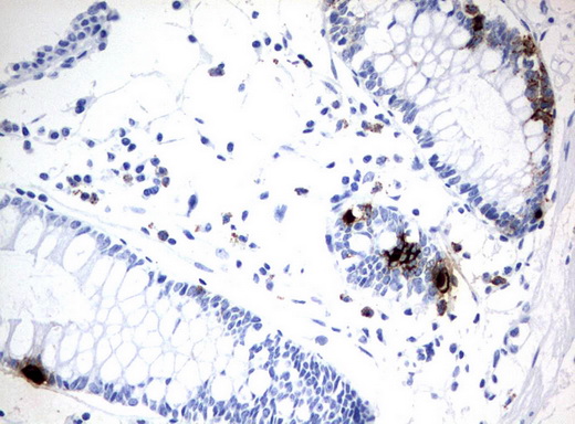 CHGA / Chromogranin A Antibody - Immunohistochemical staining of paraffin-embedded Human colon tissue using anti-CHGA mouse monoclonal antibody.  heat-induced epitope retrieval by 10mM citric buffer, pH6.0, 120C for 3min)
