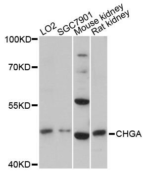 CHGA / Chromogranin A Antibody - Western blot analysis of extracts of various cell lines, using CHGA antibody at 1:1000 dilution. The secondary antibody used was an HRP Goat Anti-Rabbit IgG (H+L) at 1:10000 dilution. Lysates were loaded 25ug per lane and 3% nonfat dry milk in TBST was used for blocking. An ECL Kit was used for detection and the exposure time was 90s.