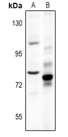 CHGB / Chromogranin B Antibody - Western blot analysis of Chromogranin B expression in HCT116 (A), PC12 (B) whole cell lysates.