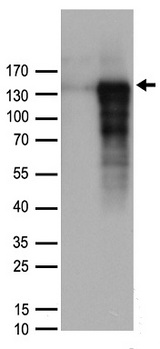 CHGB / Chromogranin B Antibody - HEK293T cells were transfected with the pCMV6-ENTRY control. (Left lane) or pCMV6-ENTRY CHGB. (Right lane) cDNA for 48 hrs and lysed. Equivalent amounts of cell lysates. (5 ug per lane) were separated by SDS-PAGE and immunoblotted with anti-CHGB rabbit polyclonal antibody .