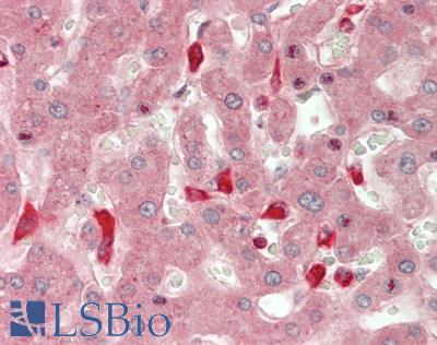 CHI3L1 / YKL-40 Antibody - Human Liver: Formalin-Fixed, Paraffin-Embedded (FFPE).  This image was taken for the unconjugated form of this product. Other forms have not been tested.