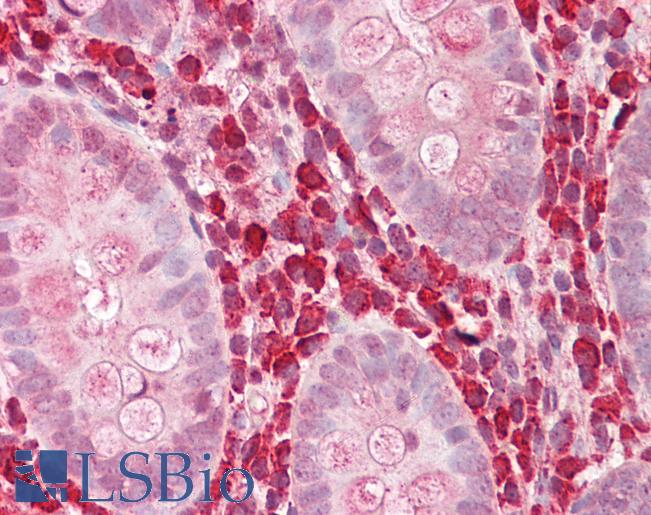 CHI3L1 / YKL-40 Antibody - Anti-YKL-40 / CHI3L1 antibody IHC of human colon. Immunohistochemistry of formalin-fixed, paraffin-embedded tissue after heat-induced antigen retrieval. Antibody dilution 2.5-5 ug/ml. This image was taken for the unconjugated form of this product. Other forms have not been tested.