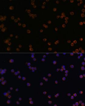 CHI3L1 / YKL-40 Antibody - Immunofluorescence analysis of Raw264.7 cells using YKL-40 / CHI3L1 Polyclonal Antibody at dilution of 1:100.Blue: DAPI for nuclear staining.