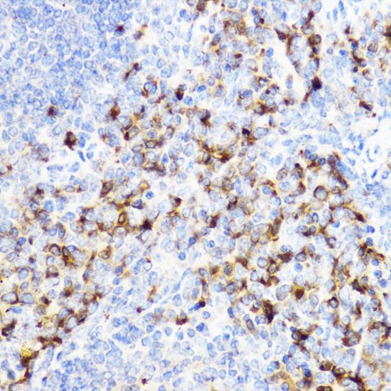 CHI3L1 / YKL-40 Antibody - Immunohistochemistry of paraffin-embedded Mouse spleen using YKL-40 / CHI3L1 Polyclonal Antibody at dilution of 1:100 (40x lens).