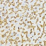 CHI3L1 / YKL-40 Antibody - Immunohistochemistry of paraffin-embedded Mouse liver using YKL-40 / CHI3L1 Polyclonal Antibody at dilution of 1:100 (40x lens).