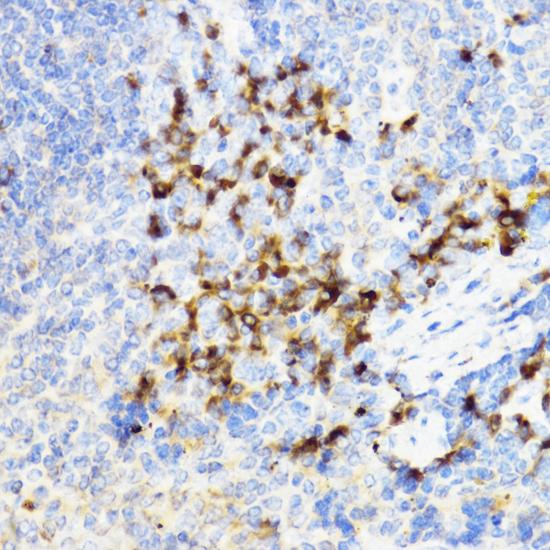 CHI3L1 / YKL-40 Antibody - Immunohistochemistry of paraffin-embedded Mouse spleen using YKL-40 / CHI3L1 Polyclonal Antibody at dilution of 1:100 (40x lens).
