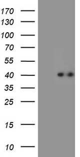 CHIA / Amcase Antibody - HEK293T cells were transfected with the pCMV6-ENTRY control. (Left lane) or pCMV6-ENTRY CHIA. (Right lane) cDNA for 48 hrs and lysed