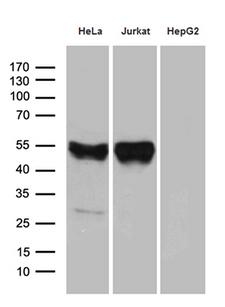 CHIA / Amcase Antibody - Western blot analysis of extracts. (35ug) from 3 different cell lines by using anti-CHIA monoclonal antibody. (1:500)