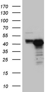 CHIA / Amcase Antibody - HEK293T cells were transfected with the pCMV6-ENTRY control. (Left lane) or pCMV6-ENTRY CHIA. (Right lane) cDNA for 48 hrs and lysed. Equivalent amounts of cell lysates. (5 ug per lane) were separated by SDS-PAGE and immunoblotted with anti-CHIA. (1:2000)