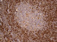 CHIA / Amcase Antibody - Immunohistochemical staining of paraffin-embedded Human tonsil within the normal limits using anti-CHIA mouse monoclonal antibody. (Heat-induced epitope retrieval by 1mM EDTA in 10mM Tris buffer. (pH8.5) at 120°C for 3 min. (1:2000)