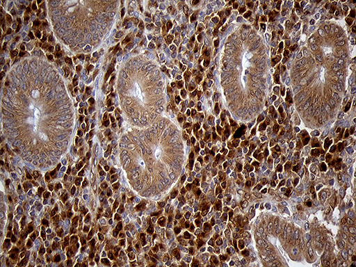 CHIA / Amcase Antibody - Immunohistochemical staining of paraffin-embedded Human appendix tissue within the normal limits using anti-CHIA mouse monoclonal antibody. (Heat-induced epitope retrieval by 1mM EDTA in 10mM Tris buffer. (pH8.5) at 120°C for 3 min. (1:2000)