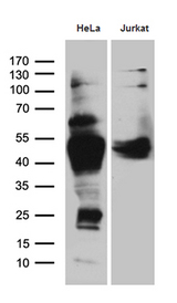 CHIA / Amcase Antibody - Western blot analysis of extracts. (35ug) from 2 different cell lines by using anti-CHIA monoclonal antibody. (1:500)