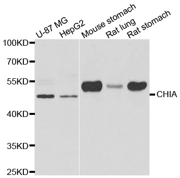 CHIA / Amcase Antibody - Western blot analysis of extracts of various cell lines.