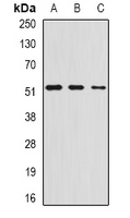 CHIA / Amcase Antibody - Western blot analysis of AMCase expression in HepG2 (A); mouse stomach (B); rat lung (C) whole cell lysates.