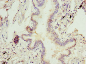 CHIA / Amcase Antibody - Immunohistochemistry of paraffin-embedded human lung tissue at dilution 1:100