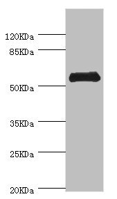 CHIA / Amcase Antibody - Western blot All Lanes:CHIA antibody at 0.74ug/ml+mouse stomach tissue Secondary Goat polyclonal to rabbit at 1/10000 dilution Predicted band size: 53,41,34 kDa Observed band size: 52 kDa