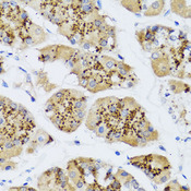 CHIC2 Antibody - Immunohistochemistry of paraffin-embedded human stomach tissue.