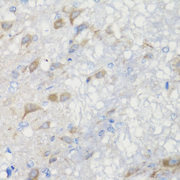 CHIC2 Antibody - Immunohistochemistry of paraffin-embedded rat brain tissue.