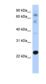 CHIC2 Antibody - CHIC2 antibody Western blot of Transfected 293T cell lysate. This image was taken for the unconjugated form of this product. Other forms have not been tested.