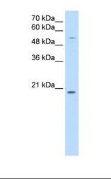CHIC2 Antibody - HepG2 cell lysate. Antibody concentration: 0.25 ug/ml. Gel concentration: 15%.  This image was taken for the unconjugated form of this product. Other forms have not been tested.