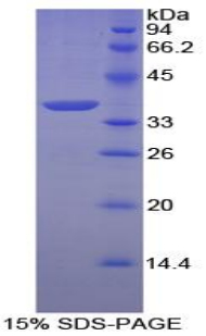 ANXA5 / Annexin V Protein - Recombinant Annexin A5 By SDS-PAGE