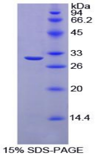 CA2 / Carbonic Anhydrase II Protein - Recombinant Carbonic Anhydrase II By SDS-PAGE