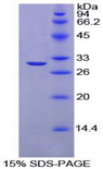 CA2 / Carbonic Anhydrase II Protein - Recombinant Carbonic Anhydrase II By SDS-PAGE
