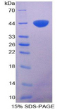 Calgizzarin / S100A11 Protein - Recombinant S100 Calcium Binding Protein A11 By SDS-PAGE