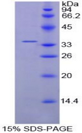CCND1 / Cyclin D1 Protein - Recombinant Cyclin D1 By SDS-PAGE