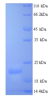 Collagen XII Alpha 1 Protein