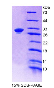 Complement C4 Protein - Recombinant Complement Component 4 By SDS-PAGE