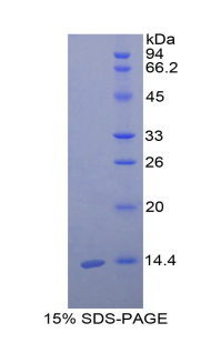 CST3 / Cystatin C Protein - Recombinant Cystatin 3 By SDS-PAGE