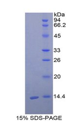 CST3 / Cystatin C Protein - Recombinant Cystatin 3 By SDS-PAGE